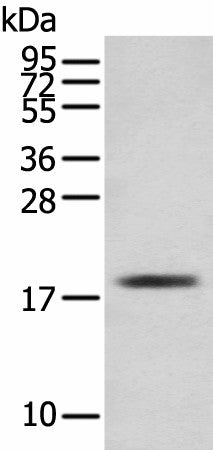 Western blot analysis of Mouse skeletal muscle tissue using TNNC1 Polyclonal Antibody at dilution of 1:250