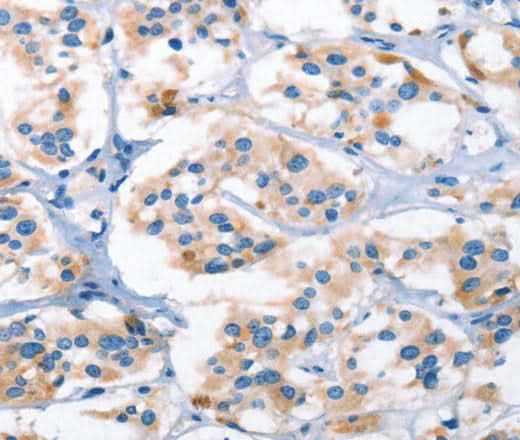 Anti-Human/Mouse/Rat AHR Antibody