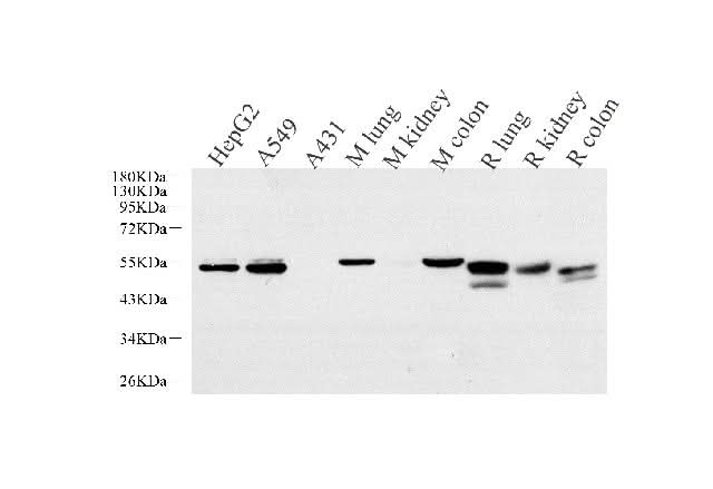 Western Blot analysis of various samples using CK-7 Monoclonal Antibody at dilution of 1:1000.
