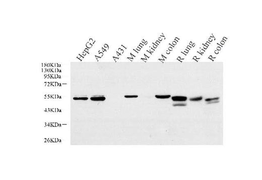 Western Blot analysis of various samples using CK-7 Monoclonal Antibody at dilution of 1:1000.