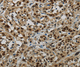 Anti-Human/Mouse/Rat LIG1 Antibody - ABMIUM