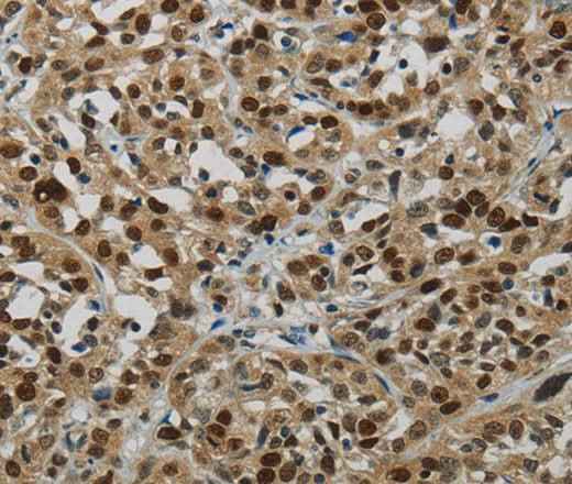 Anti-Human/Mouse/Rat LIG1 Antibody