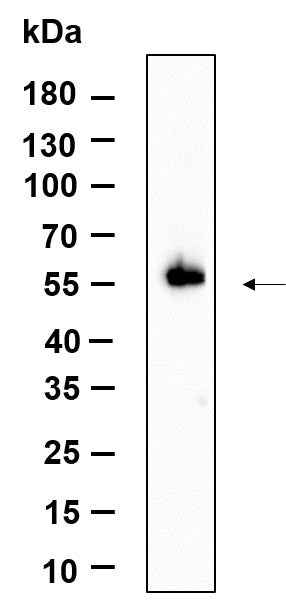 Anti-Human/Mouse/Rat STK3 Antibody [B949] - ABMIUM