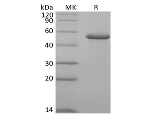 Recombinant Human RCN2 (C-6His) - ABMIUM
