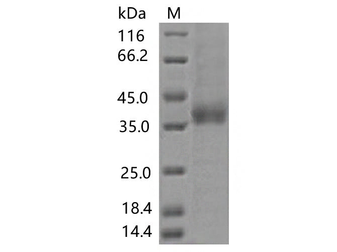 > 85 % as determined by reducing SDS-PAGE.