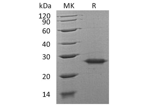 Recombinant Human Grancalcin/GCA Protein - ABMIUM