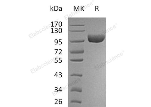 Recombinant Human VAP-1/AOC3 Protein (His Tag) - ABMIUM