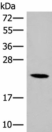 Western blot analysis of 293T cell lysate using DHFR Polyclonal Antibody at dilution of 1:400