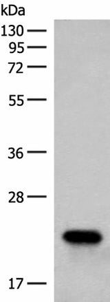 Western blot analysis of Human fetal brain tissue lysate using RAC3 Polyclonal Antibody at dilution of 1:400