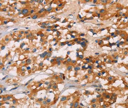 Anti-Human CD80 Antibody