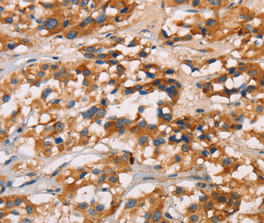 Anti-Human CD80 Antibody - ABMIUM