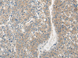 Anti-Human/Mouse/Rat CLIC6 Antibody - ABMIUM