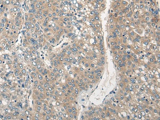 Anti-Human/Mouse/Rat CLIC6 Antibody - ABMIUM