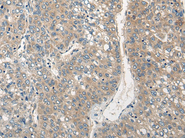 Anti-Human/Mouse/Rat CLIC6 Antibody - ABMIUM