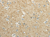 Anti-Human/Mouse WNT2 Antibody - ABMIUM