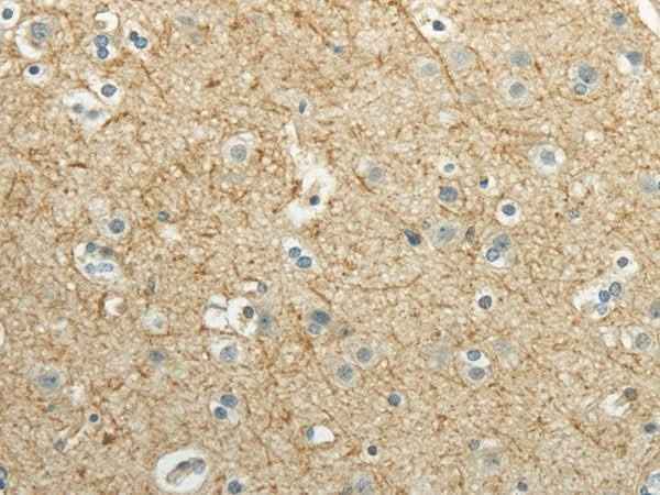 Anti-Human/Mouse WNT2 Antibody