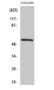 Western Blot analysis of COLO205 cells with Smad2 Polyclonal Antibody.
