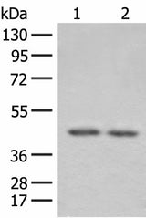 Western blot analysis of 293T cell lysates using ILKAP Polyclonal Antibody at dilution of 1:800