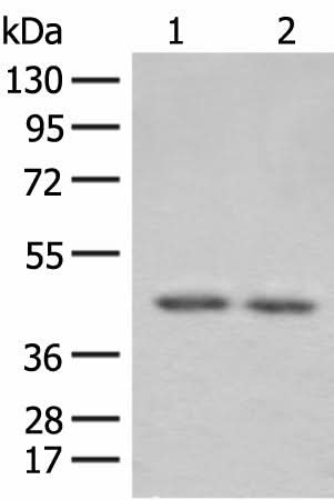 Western blot analysis of 293T cell lysates using ILKAP Polyclonal Antibody at dilution of 1:800