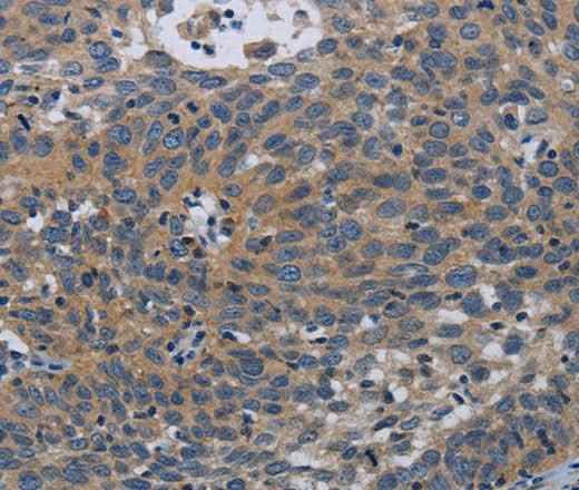 Anti-Human/Mouse PAPPA Antibody