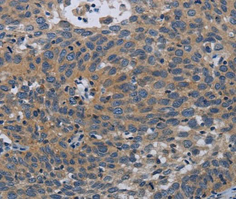 Anti-Human/Mouse PAPPA Antibody - ABMIUM