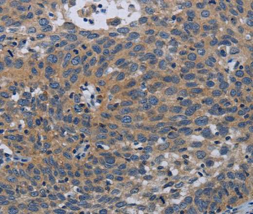 Anti-Human/Mouse PAPPA Antibody - ABMIUM