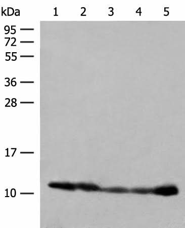 Western blot analysis of 293T cell PC-3 cell Human liver tissue lysates using ATP5I Polyclonal Antibody at dilution of 1:400