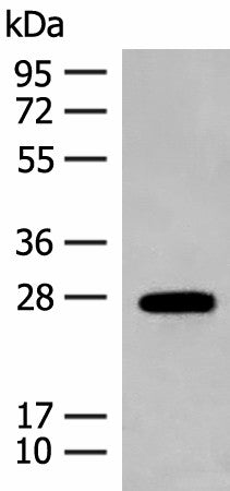 Anti-Human/Mouse GUCA1B Antibody - ABMIUM