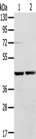 Anti-Human/Mouse/Rat RRAGA Antibody - ABMIUM