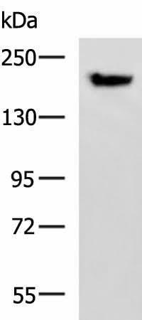 Western blot analysis of Mouse brain tissue lysate using PDS5B Polyclonal Antibody at dilution of 1:800