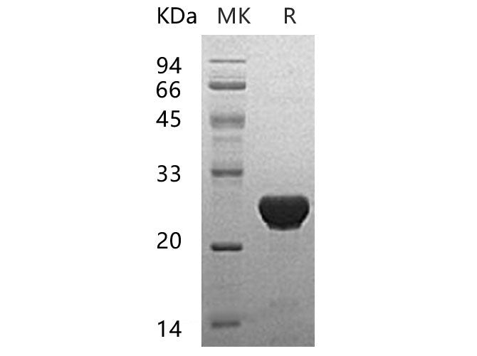 Recombinant Human UBE2T Protein (His Tag) - ABMIUM