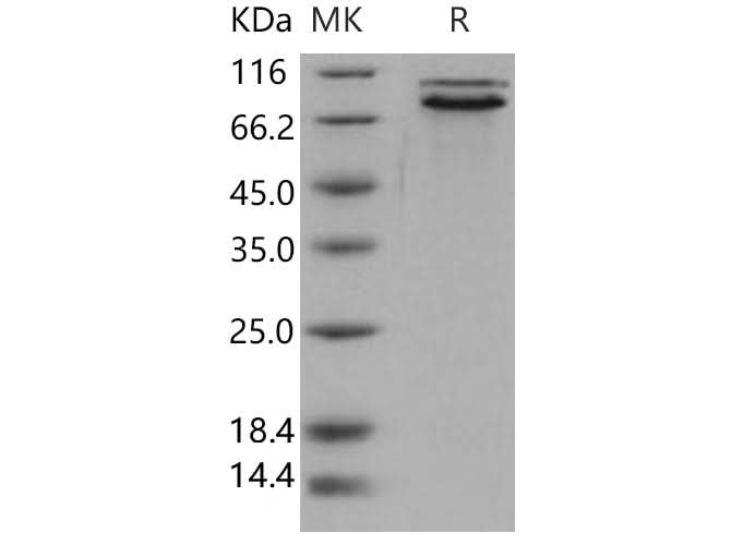 Recombinant Human E-Cadherin/CDH1 Protein (His Tag) - ABMIUM