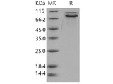 Recombinant Human E-Cadherin/CDH1 Protein (His Tag) - ABMIUM