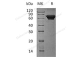 Recombinant Human MAN1B1 Protein (His Tag) - ABMIUM
