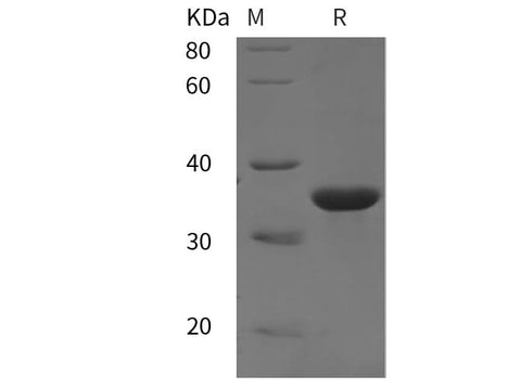 SDS-PAGE analysis of Rat IGFBP1/IGFBP-1 proteins, 2 μg/lane of Recombinant Rat IGFBP1/IGFBP-1 proteins was resolved with SDS-PAGE under reducing conditions, showing bands at 35 kDa.