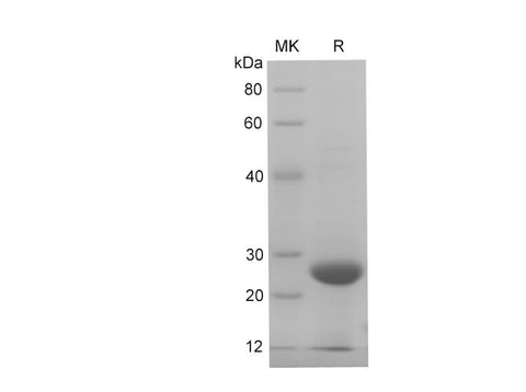 SDS-PAGE analysis of Rat S100B proteins, 2 μg/lane of Recombinant Rat S100B proteins was resolved with SDS-PAGE under reducing conditions, showing bands at 28 kDa.