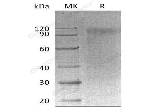 Recombinant Mouse SIRPA/CD172a Protein (MIgG2a Tag) - ABMIUM