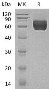 Recombinant Human GALNTL1 Protein (His Tag) - ABMIUM