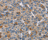 Anti-Human/Mouse/Rat DNMT3A Antibody - ABMIUM