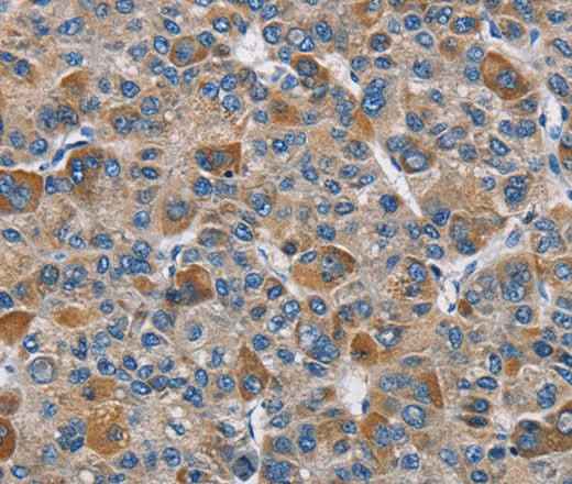 Anti-Human/Mouse/Rat DNMT3A Antibody