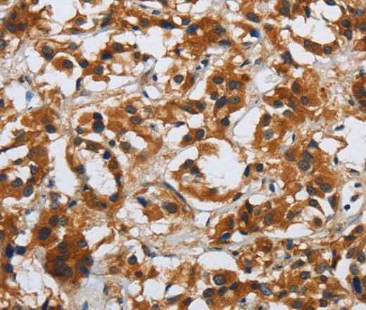 Anti-Human/Mouse DSP Antibody