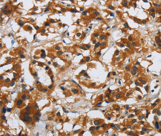 Anti-Human/Mouse DSP Antibody - ABMIUM