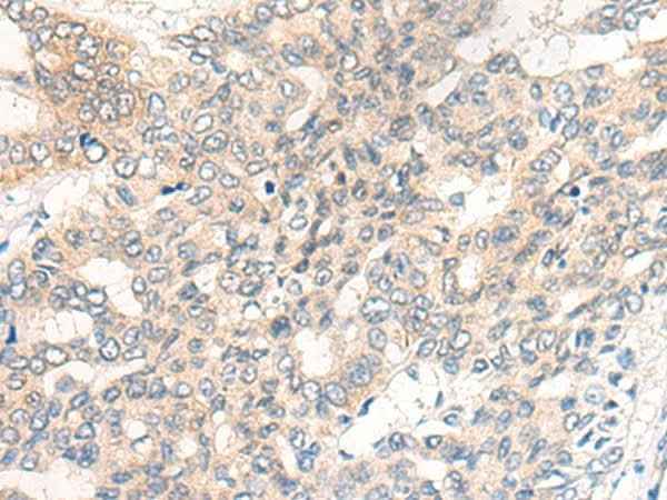 Anti-Human/Mouse/Rat CHRD Antibody