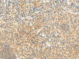 Immunohistochemistry of paraffin-embedded Human tonsil tissue using CD93 Polyclonal Antibody at dilution of 1:50(×200)