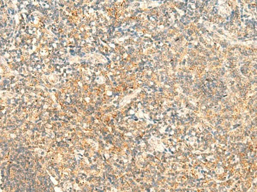 Immunohistochemistry of paraffin-embedded Human tonsil tissue using CD93 Polyclonal Antibody at dilution of 1:50(×200)
