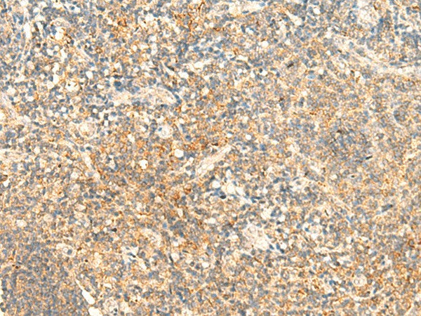Immunohistochemistry of paraffin-embedded Human tonsil tissue using CD93 Polyclonal Antibody at dilution of 1:50(×200)