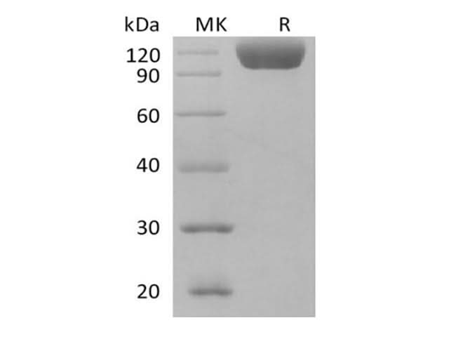 Recombinant Human Siglec-10 (C-Fc) - ABMIUM