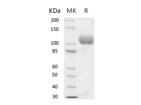 Recombinant Human ACE2 Protein (His Tag) - ABMIUM