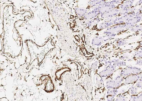 Anti-Human VIM Antibody [A1217] - ABMIUM