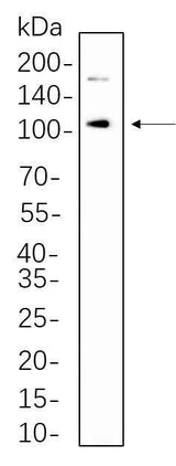 Anti-Human/Mouse/Rat IRE1α Antibody [B1111]